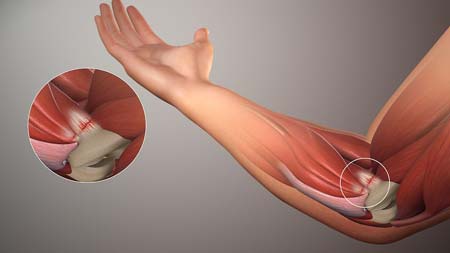 نتیجه تصویری برای تمرین انعطاف پذیری آرنج و مچ دست