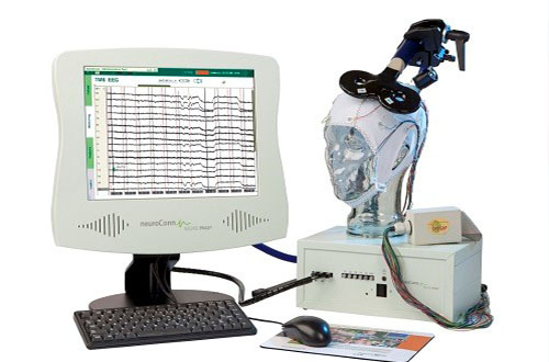 TMS یا RTMS مبتنی بر نوار مغز