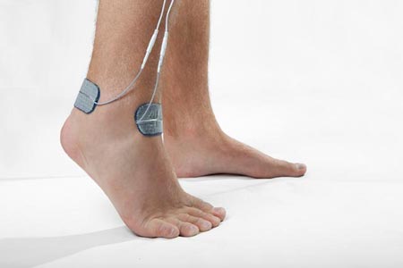 روماتیسم پا چگونه بروز میکند