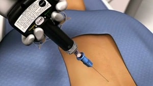 مگنت تراپی دیسک کمر