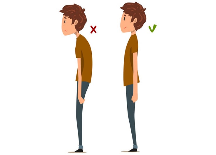 علت ابتلا به کیفوز در دوران کودکی چیست؟