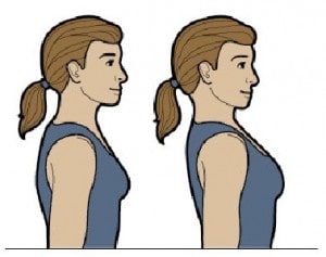 ورزش و حرکات اصلاحی درمان گردن درد