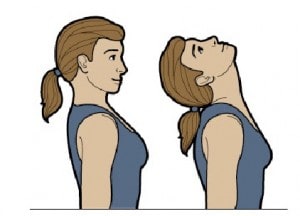 ورزش و حرکات اصلاحی درمان گردن درد